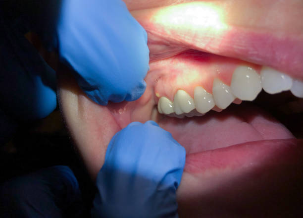 Best Pediatric Emergency Dentist in Guin, AL